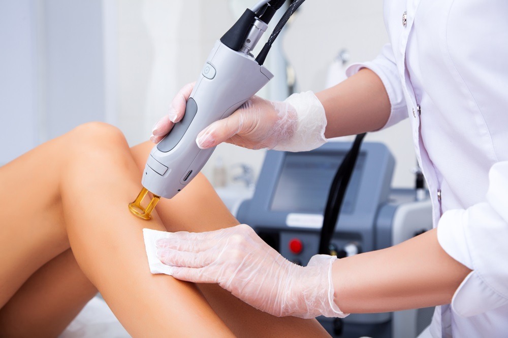 At-Home vs Professional Laser Hair Removal | Which is Better?