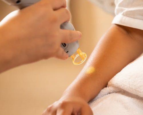 Close-up of a laser hair removal session at a spa, emphasizing professional skincare and relaxation.